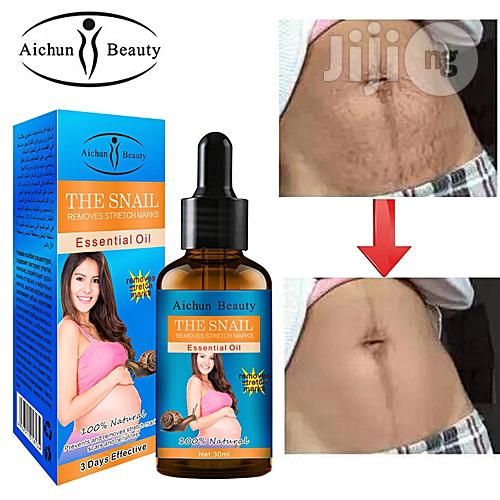 snail remove stretch marks cream