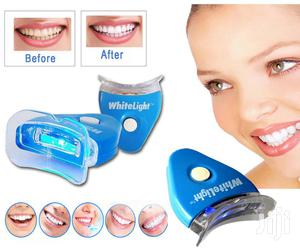 Bright Smile Dental Tooth Whitening Kit