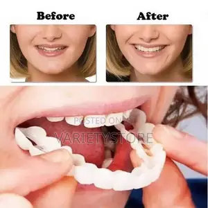 Snap-on Smile Fake Teeth Denture Braces - 2 PCS