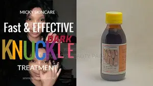Fongicide Knuckle Wash / Fade Off Dark Knuckles Fast