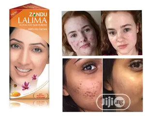 Lalima Blood And Skin Purifier
