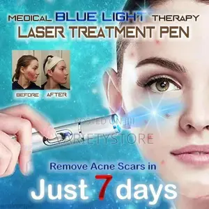 Blue Light Therapy Laser Pen Spider Vein Acne Removal Tool