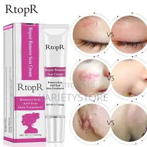 Rtopr Acne Scar Stretch Marks Remover Cream