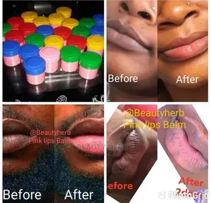 5 Days Permanent Pink Lips Balm for Both Man and Woman