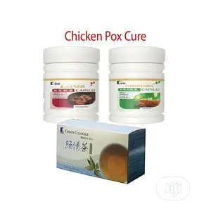 Kedi Chicken Pox Treatment
