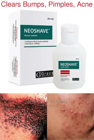 Neoshave Acne Lotion -advance Form Of Nemedrol Bumps,Pimples
