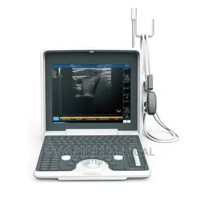 Digital Cheapest Portable Laptop B/W Ultrasound Scanner