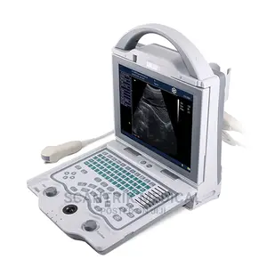 Laptop Ultrasound Equipment