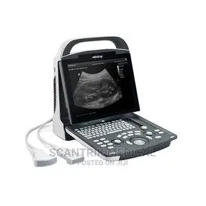 Portable Hospital Ultrasound Machine With Probe