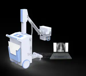 High Quality Medical X Ray Equipment, Mobile XRAY