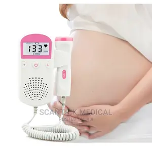 Fetal Doppler From Parents