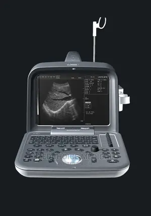 2d Table Top Ultrasound Machine