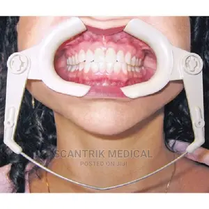Plastic Dental Mouth Opener White Medical Cheek Retractor