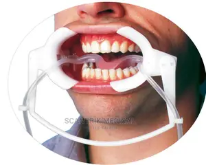 Cheek Retractor Retractors Teeth Whitening Lip Mouth