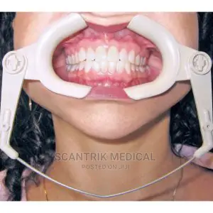 Lip Retractor With Handles for Dental Photography