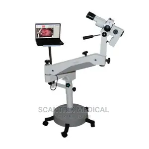 Cervical Cancer Colposcopy Machine