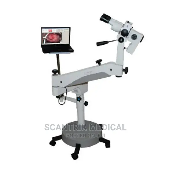 Cervical Cancer Colposcopy Machine