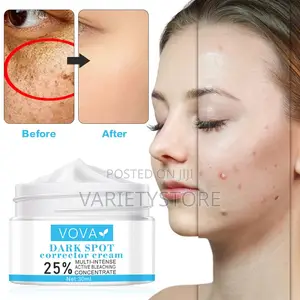 Vova Dark Spots Remover Whitening Cream