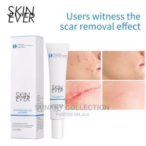 Herbal Scar Remover Cream Surgical Scar Face Body Skincare